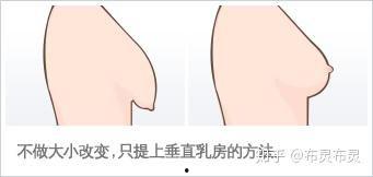 乳房下垂矫正术视频,术前术后护理与恢复技巧